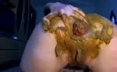 Hairy teen fisting her cunt