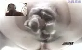 Close up of teen shitting